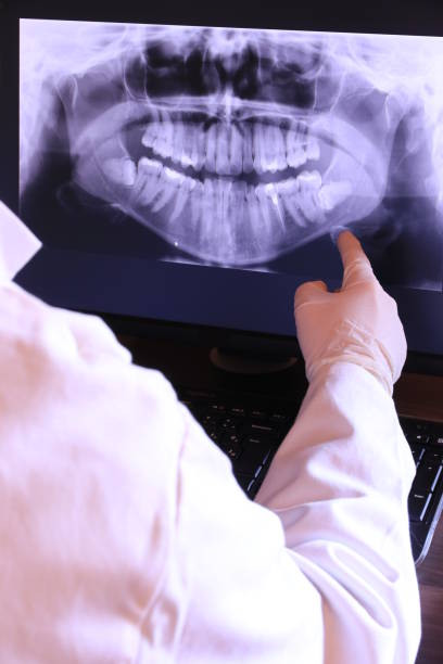 Best Emergency Dentist for Knocked-Out Tooth in Walcott, IA